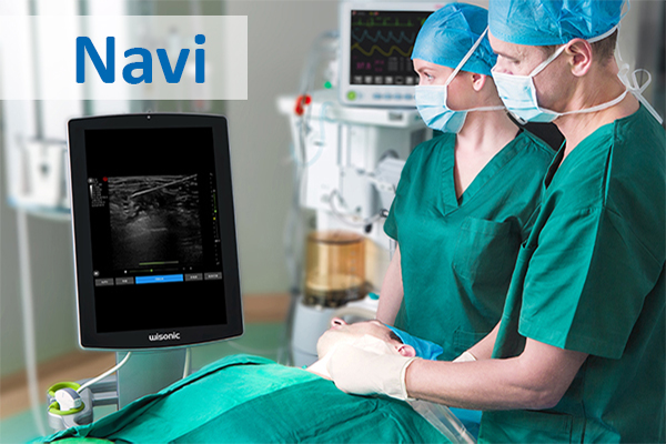 wisonic - Navi Professionelles Anästhesie- und Point-of-Care Ultraschallsystem. endocon diagnostics