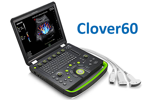 wisonic Clover60 Leicht tragbares Ultraschallgerät endocon diagnostics